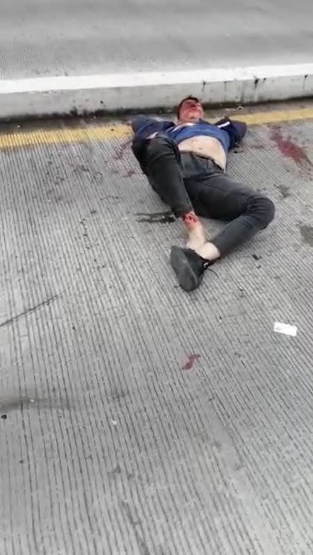 Joven sufrió accidente en paso elevado del Batallón
