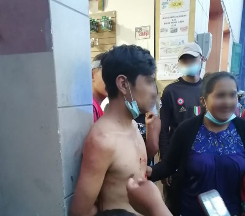 Apuñalado por robar cuatro cajas de mascarillas