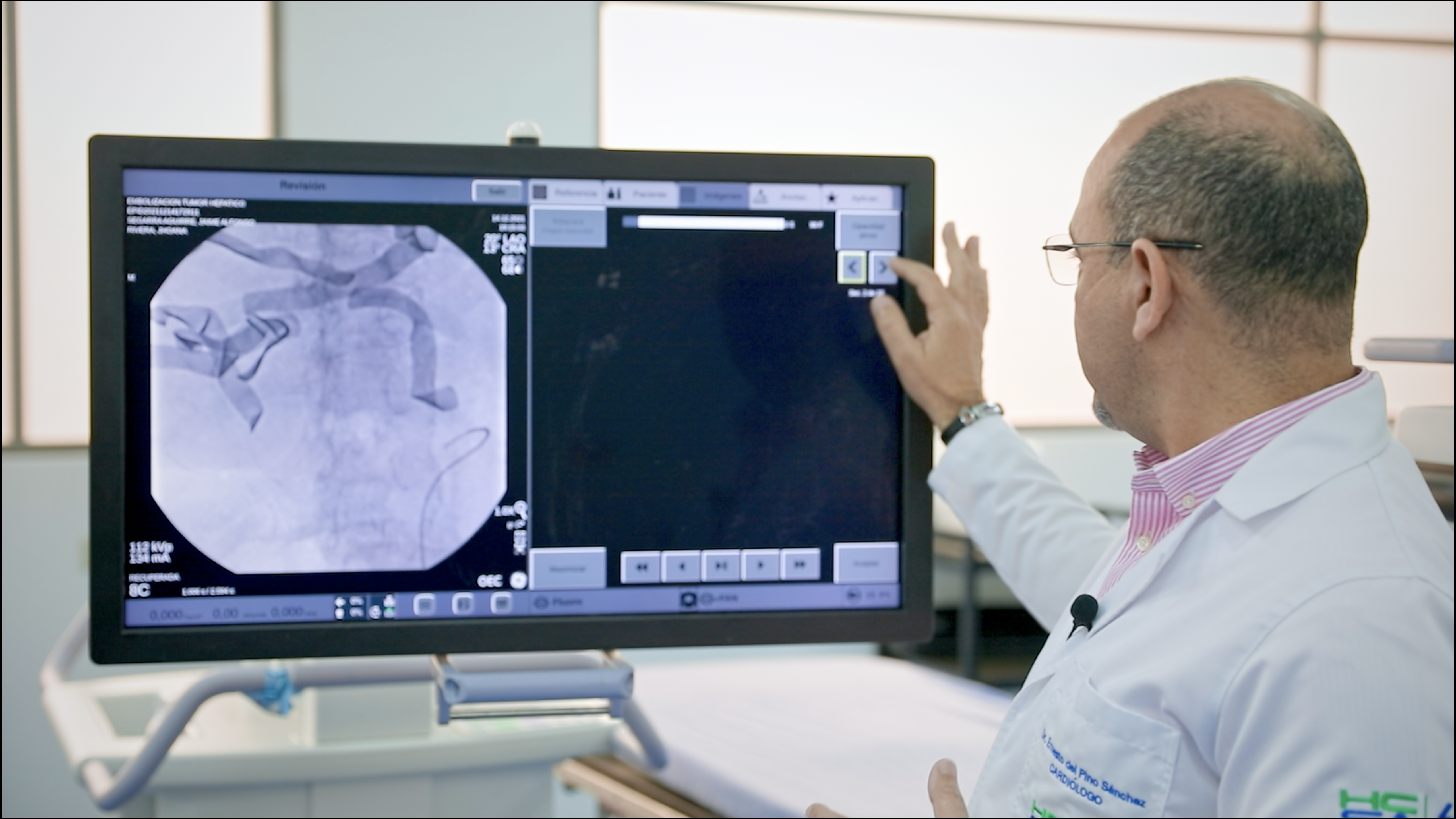 Clínica San Agustín realiza embolización de masa hepática