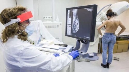 Incrementan la eficacia de la inmunoterapia en el cáncer de mama