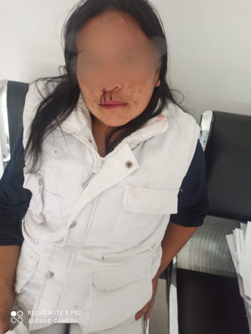 La mujer violentada presentaba golpes en su rostro y sangre en la nariz