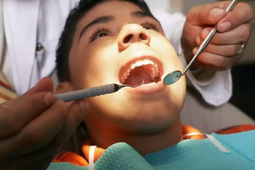 Adolescentes pierden sus  dientes por la ansiedad