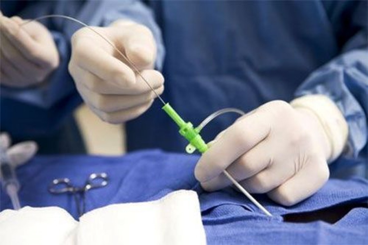 Servicio de laparoscopía disponible en Solca