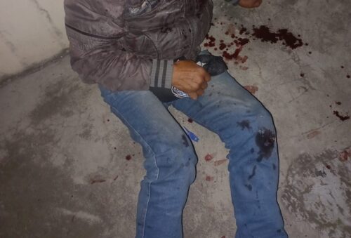 Presunto ladrón se cae mientras intentaba escapar