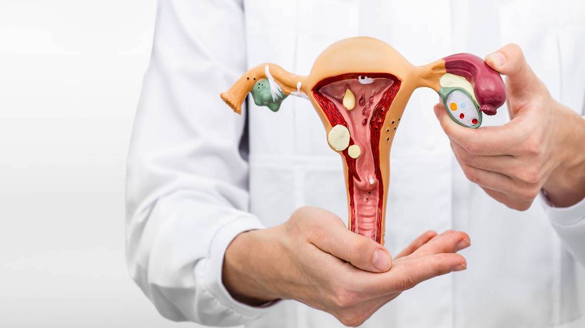 ¿Cómo prevenir el cáncer de cuello uterino? La segunda causa de muerte más común en mujeres