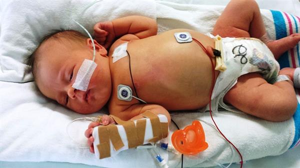 ATENCIÓN. Los virus respiratorios están afectando con mayor intensidad a recién nacidos.