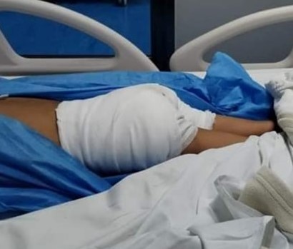 En Ecuador los padres creen que golpear a sus hijos es parte del crecimiento personal