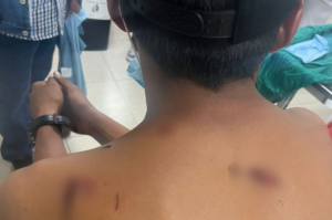 Hombres es detenido por herir a  un joven con el pico de una botella