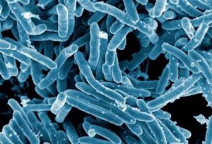 La OMS destaca la recuperación en el diagnóstico y tratamiento de la tuberculosis en 2022 tras los efectos del Covid-19