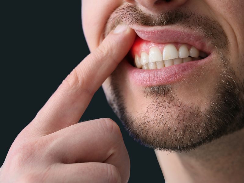 Una buena salud bucal puede prevenir la disfunción eréctil.